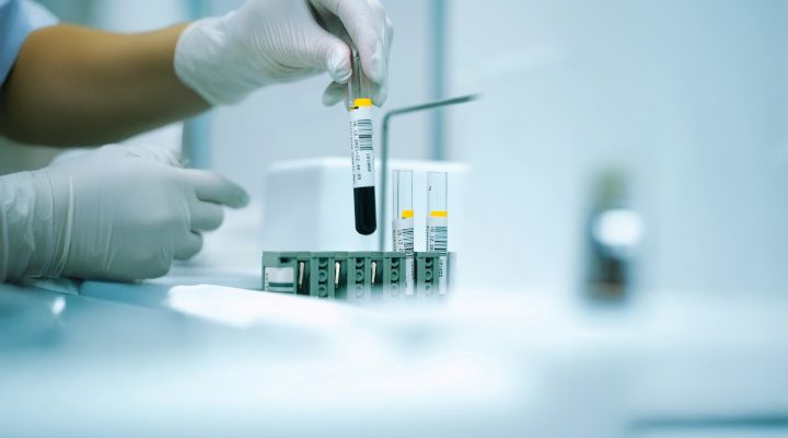 általános laborvizsgálat